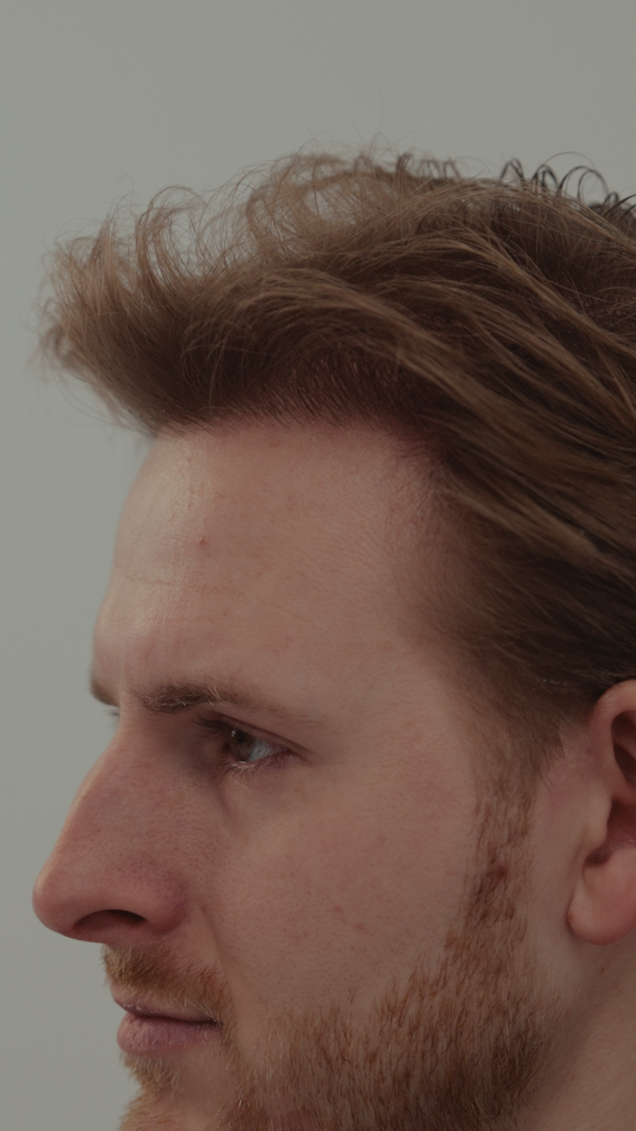 AHI – Koen After (Stills) 6