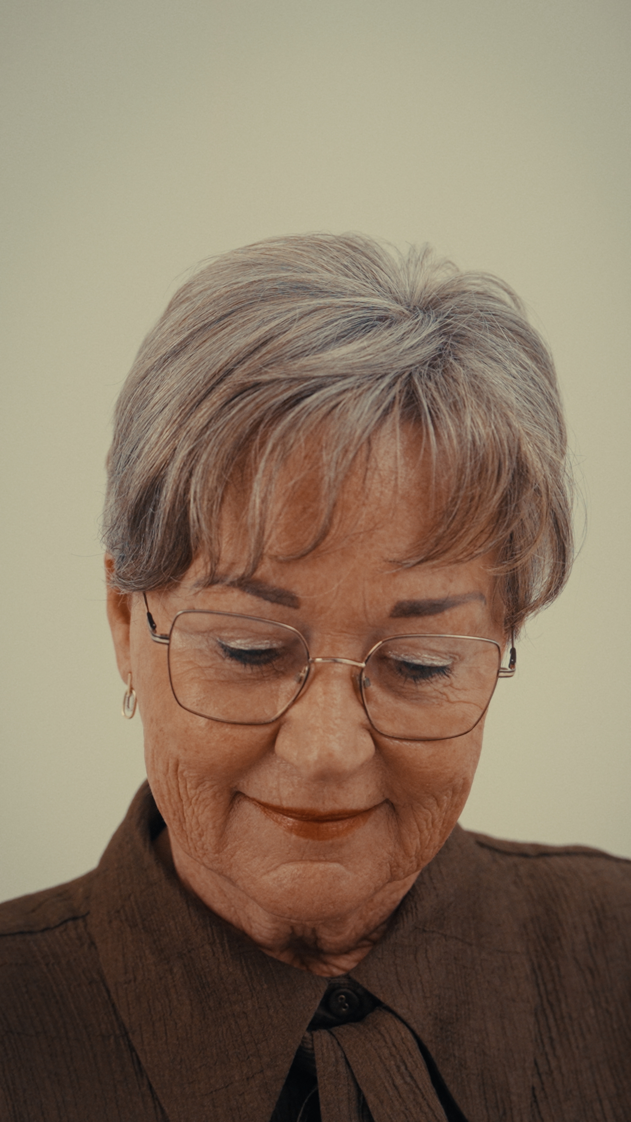 Detail haarlijn – haartransplantatie vrouw (75) haarlijn vrouw 75 haartransplantatie detail voorzijde FUE CT resultaat