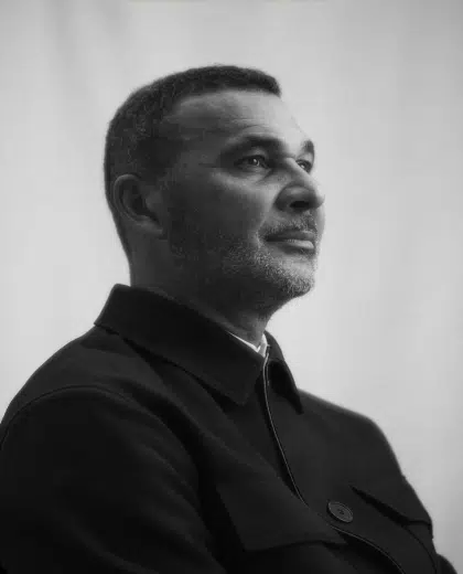 Resultaat van een FUE CT haarlijncorrectie bij kroeshaar van Ruud Gullit bij Amsterdam Hair Institute.