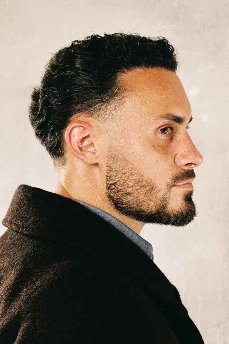 matti-swinnen-zijprofiel-portret-haartransplantatie-768×1152.jpg